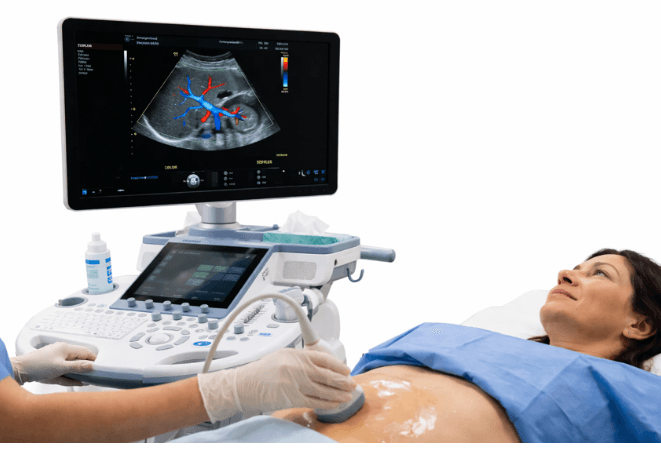 Doppler Abdominal