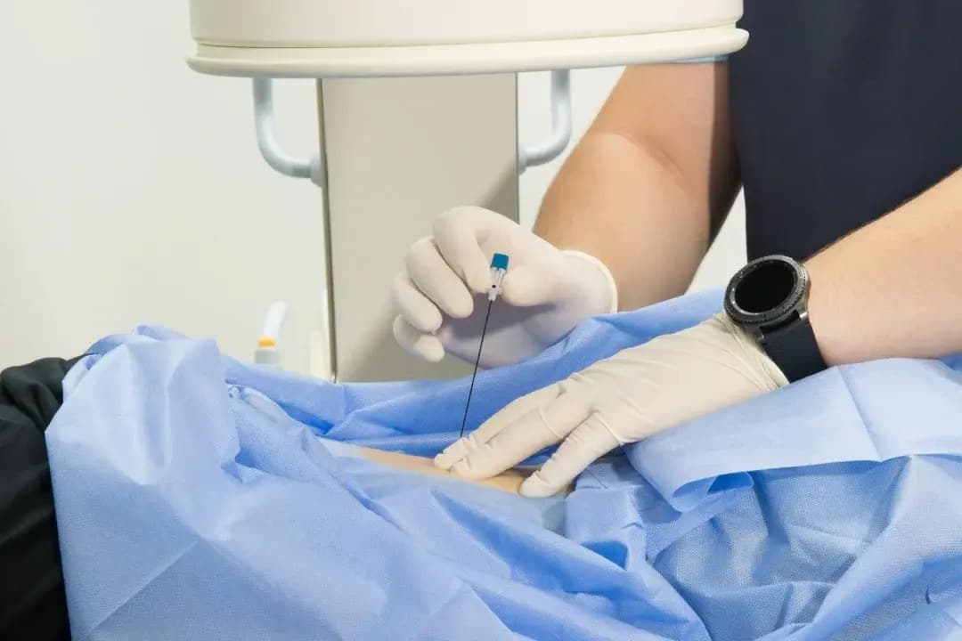 Bloqueos del dolor